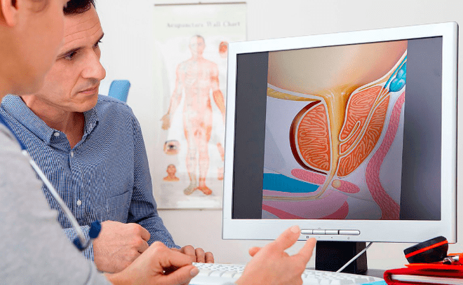 Diagnostic de prostatite